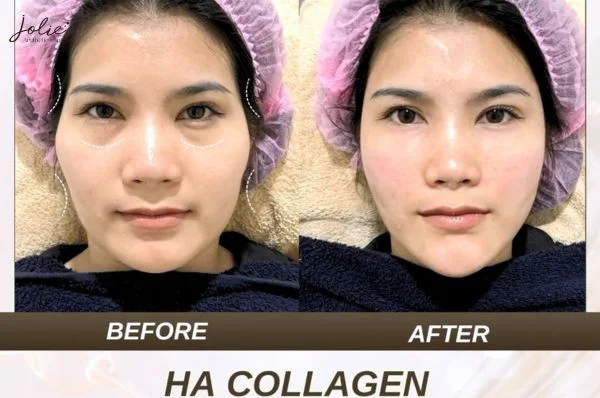 Answering beauty-related skin questions
