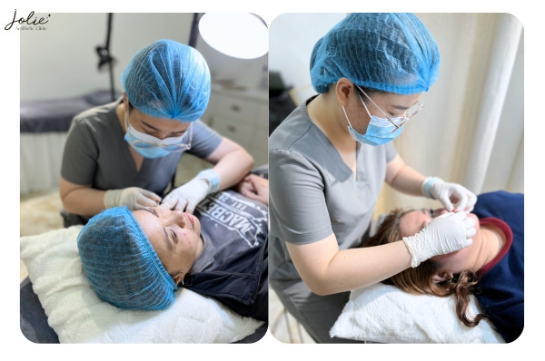  Jolie Aesthetic Clinic is the most prestigious and highest quality acne treatment address