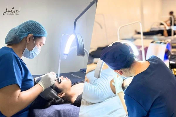 You need to treat acne promptly to avoid permanent scarring