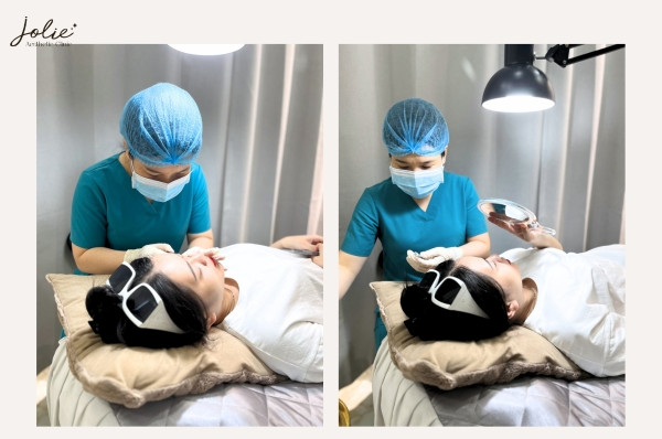 Learn About the Chin Slimming Injection Procedure