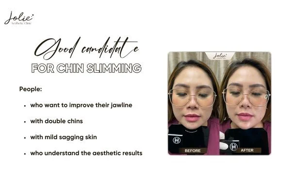 Who is a good candidate for chin slimming
