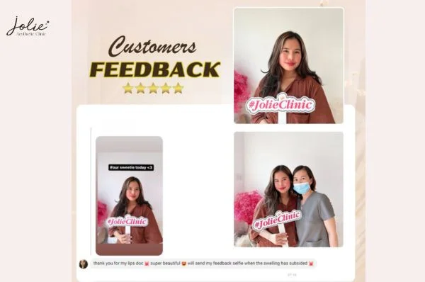 Do issues arise with filler injections in the Philippines?