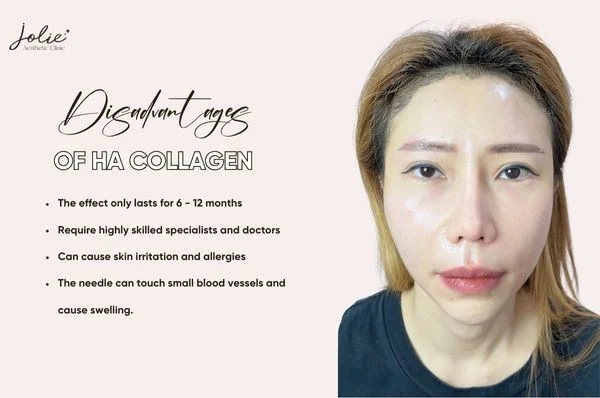 Disadvantages of HA collagen injection