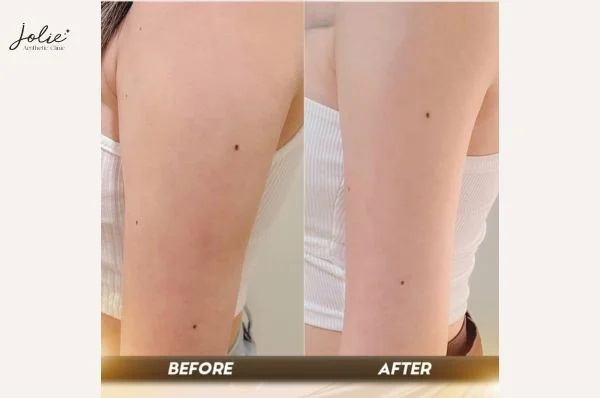 For the greatest service, visit Jolie Clinic