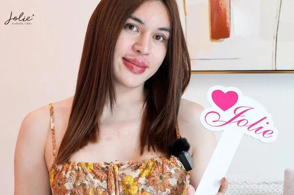 Lip filler injections have become very popular today