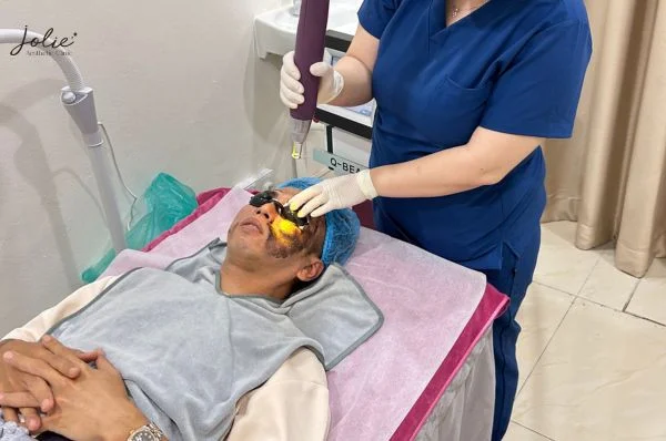 Transform your skin with our specialized melasma mustache care