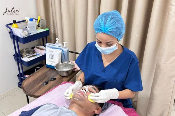Restore your natural glow with melasma mustache treatment